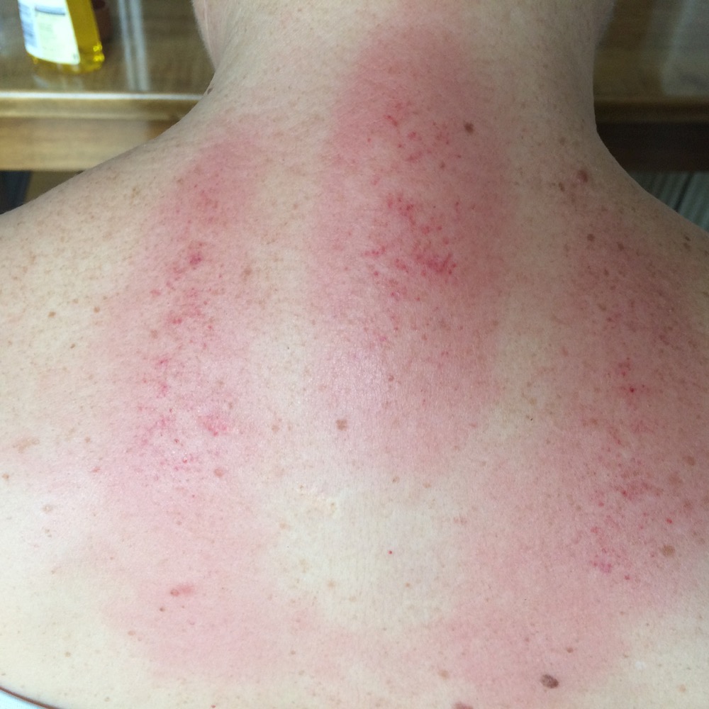 Gua Sha Gua Sha